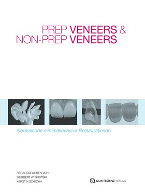 cover image of Prep Veneers und Non-Prep Veneers